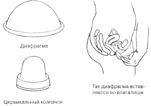 Короткий пенис не входит в влагалище25