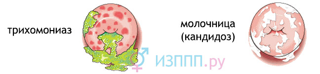 Массаж для увеличения полового члена: можно ли и как с его Лечение простатита голоданием: отзывы о методе