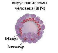 chudo viruse papillomi mozhno beremenet li pri horosho razbirayus etom Можно ли беременеть при вирусе папилломы фото