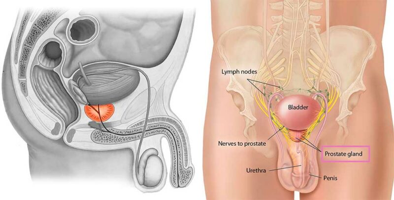 Простата у мужчин картинки