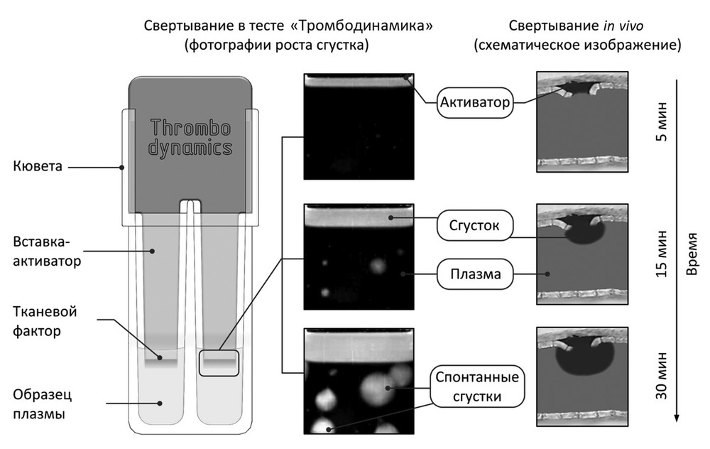 Тромбодинамика инвитро. Тромбодинамика показатели. Исследование тромбодинамики. Тест Тромбодинамика. Тромбодинамика анализ.