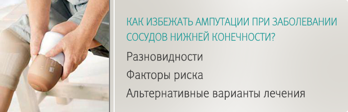 Альтернативная ампутация ноги. Заживление после ампутации стопы.