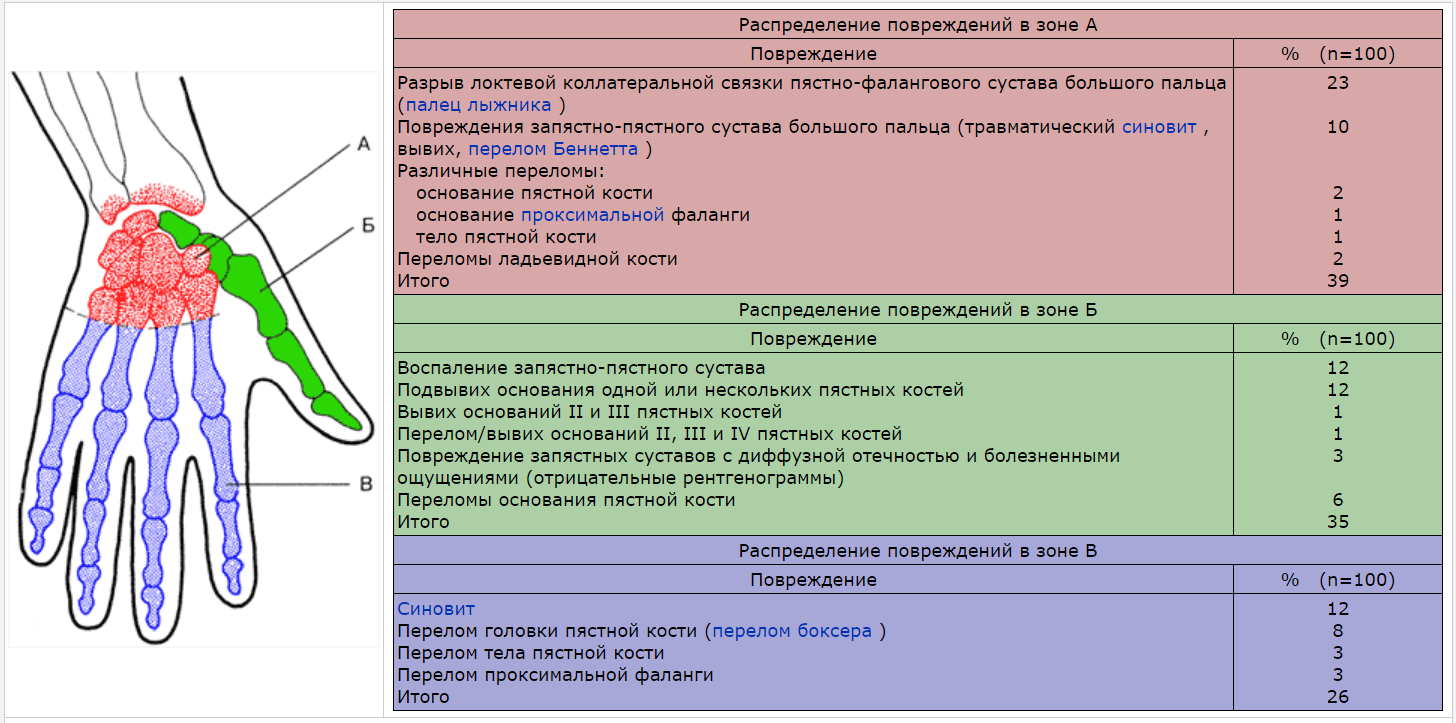 Пястнофалагового сустава. Повреждение запястно-пястного сустава.