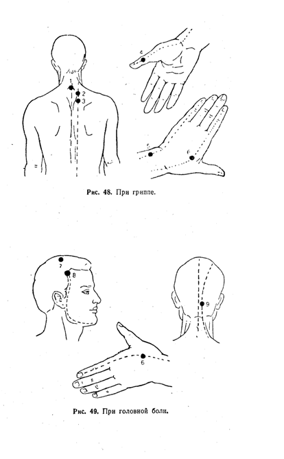 Точки от головной боли. Рефлексотерапия точки воздействия при боли. Акупунктура при головной боли точки у детей. Акупунктурные точки на теле человека от головной боли. Акупрессура точки при головной боли.