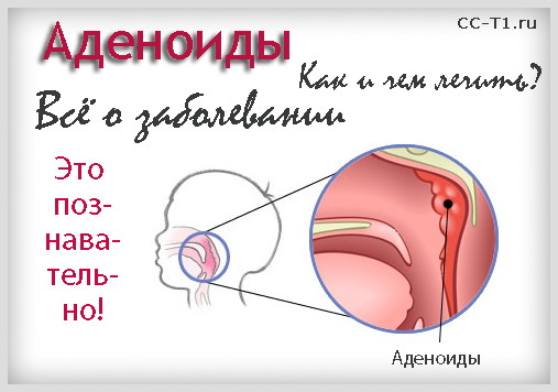 Лечить аденоиды у ребенка форум