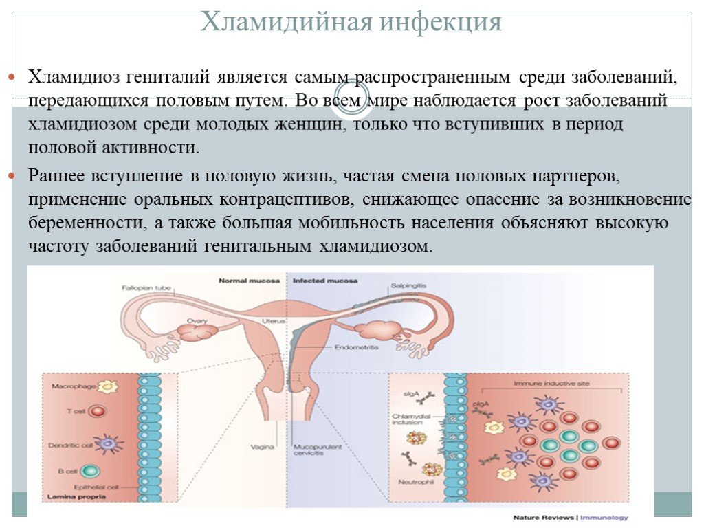 Хламидиоз у беременных. Хламидии источник заражения. Урогенитальный хламидийная инфекция.