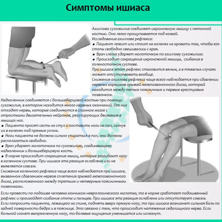 Болят суставы поясница и ноги