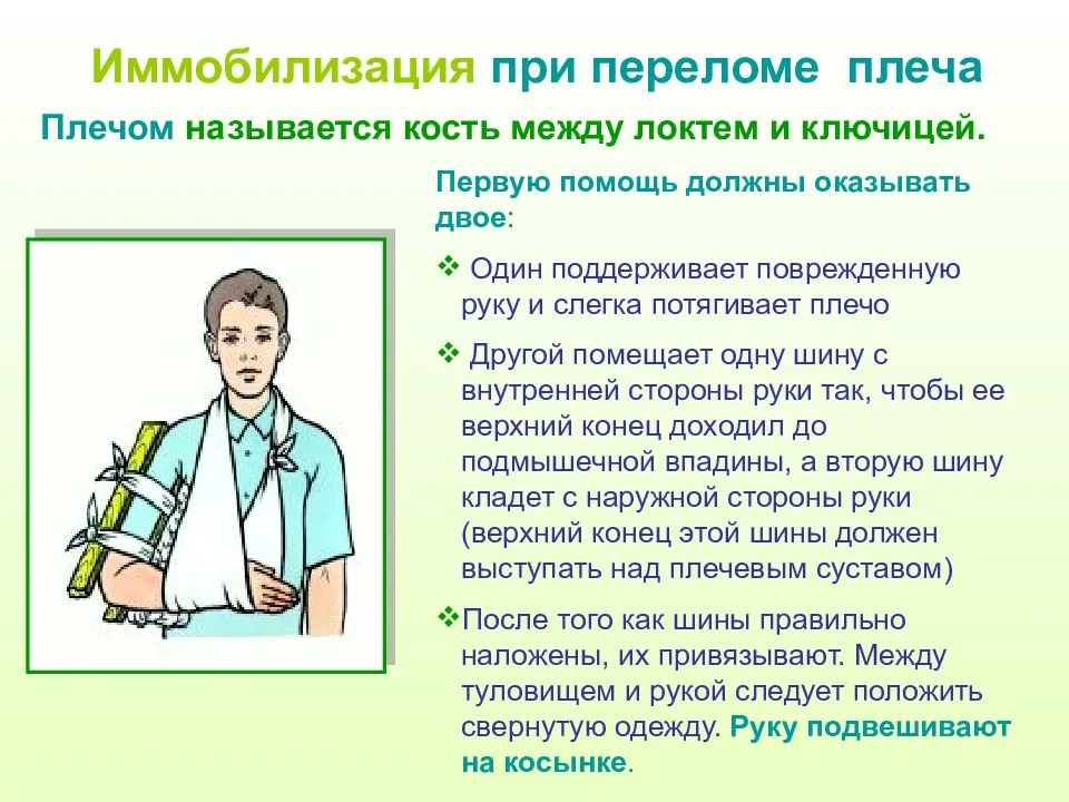 Иммобилизация кости. Протяженность иммобилизации при переломе плечевой кости. Первая помощь при переломе плечевой кости. ПМП при переломе плечевой кости. Транспортная иммобилизация при травме (переломе) плеча.