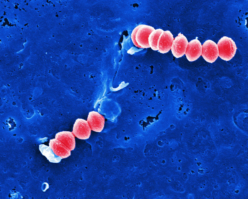 Streptococcus. Пиогенес стрептококков. Токсины гемолитического стрептококка. Токсигенный стрептококк. Гноеродный стрептококк.