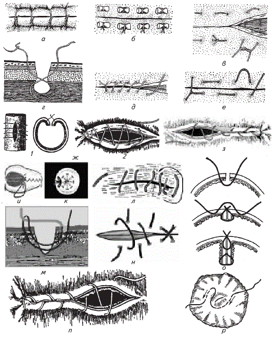 Пластический шов. Кисетный шов в хирургии Ветеринария. Узловатый шов в хирургии Ветеринария. Техника наложения хирургических швов. Провизорные швы хирургия.