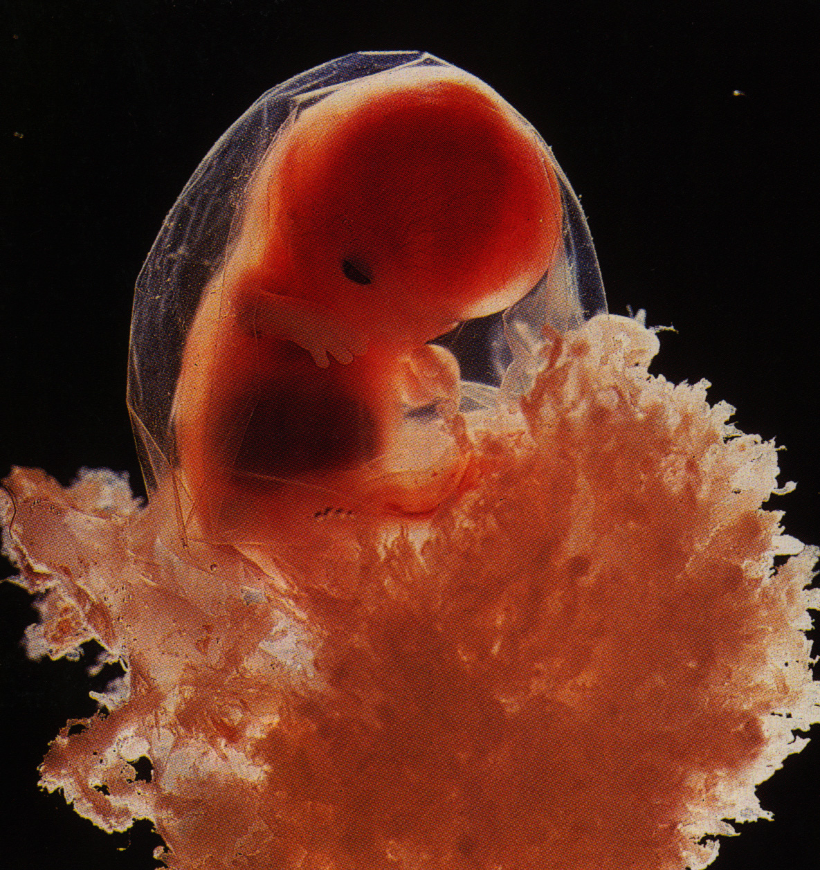 6 неделя что происходит с малышом. Эмбрион на 4 эмбриональной неделе беременности. Зародыш 3-4 недели беременности. Юбрион в 4 недели беременности.