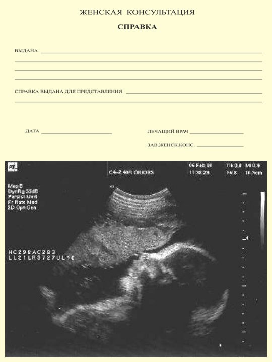 Справка о беременности фото 2 недели беременности