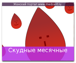 О чем говорят скудные месячные. Скудные месячные это норма. Скудные месячные как определить. Как выглядят скудные месячные.