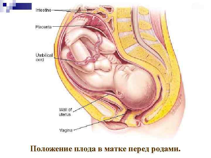 Правильное расположение плода перед родами
