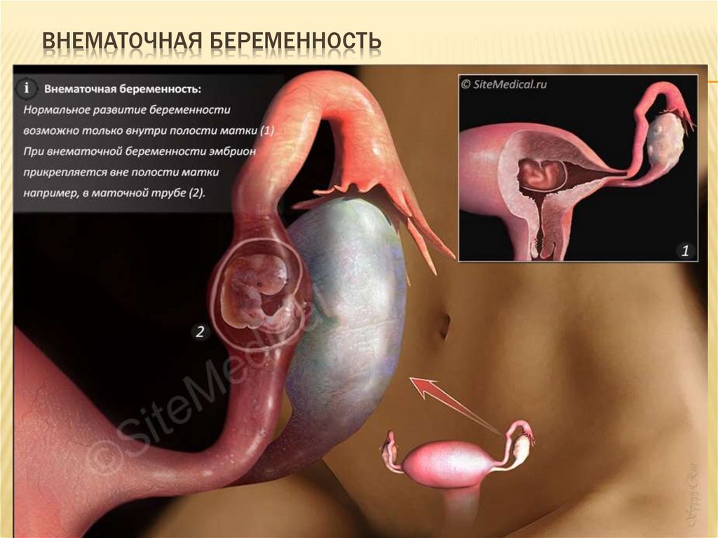 Фото Операция Женский Половой Орган