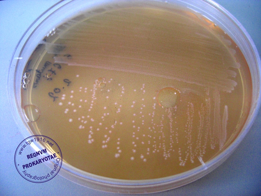 Staphylococcus aureus среда. Стрептококк рост на питательных средах. Сывороточный агар стрептококки. Стрептококк на чашке Петри. Стрептококки на сахарном агаре.