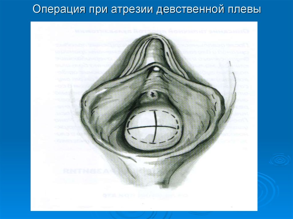 Очко Альбины расширяется от каждого проникновения