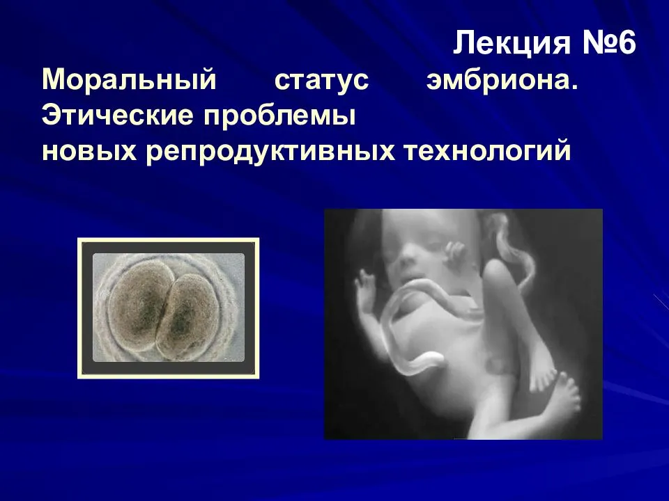 Этические проблемы репродуктивных технологий. Этический статус эмбриона. Статус человеческого эмбриона. Морально этические проблемы новых репродуктивных технологий. Проблемы репродуктивных технологий.